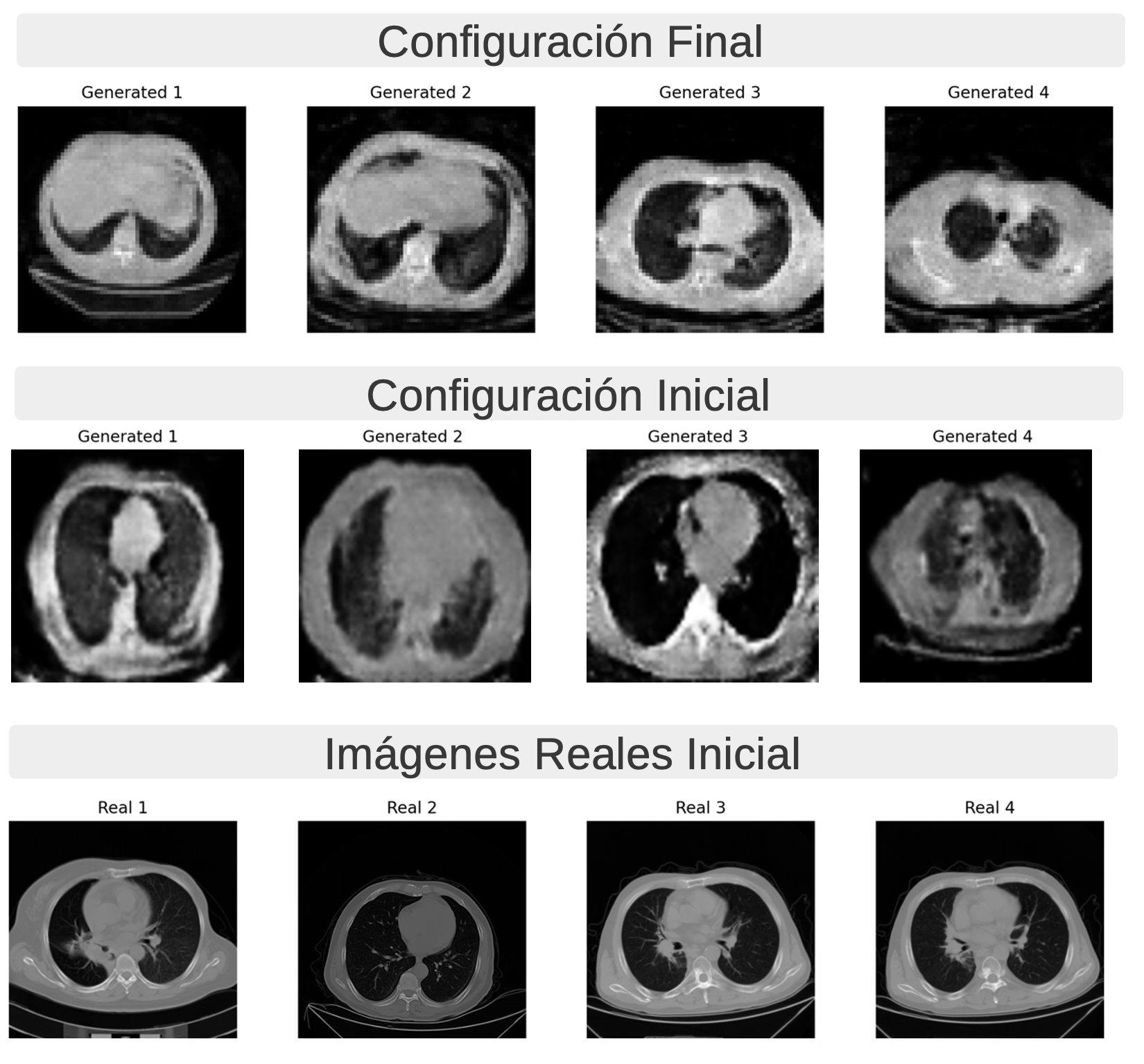 Comparación de configuraciones del modelo